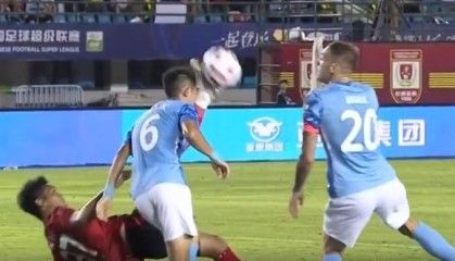 新鹏城官方：廖力生鼻骨粉碎性骨折，目前已顺利完成手术